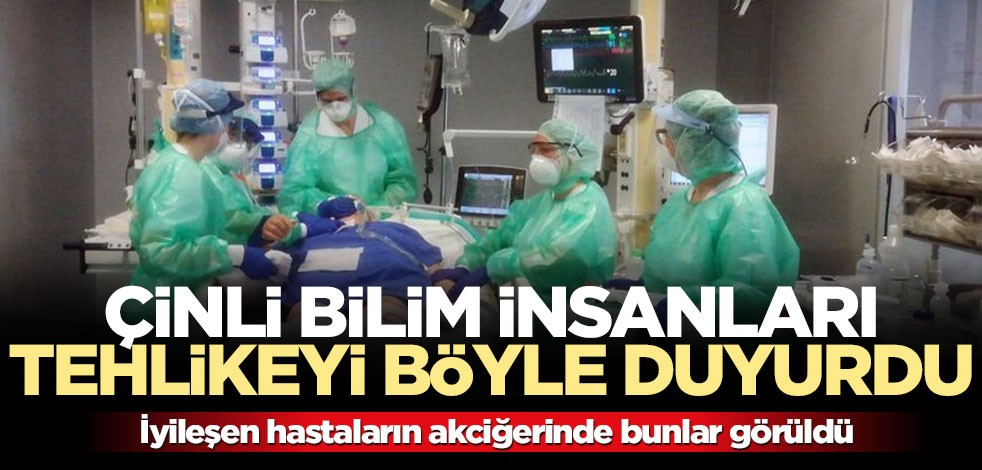 İyileşen koronavirüs hastalarının akciğerinde sıvı veya parçacık dolu keseler bulundu!