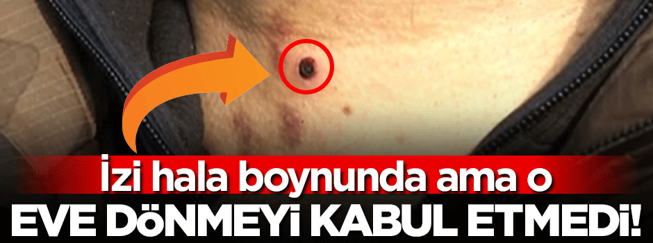 İzi hala boynunda ama o eve dönmeyi kabul etmedi