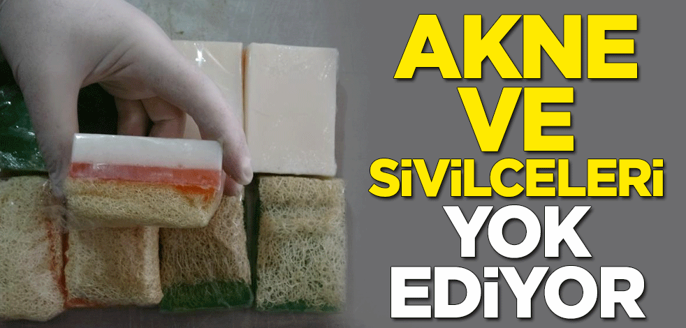 Kabak lifi sabunu akne ve sivilceleri yok ediyor