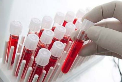 Kadınlarda hormon bozukluğu nedenleri nelerdir?