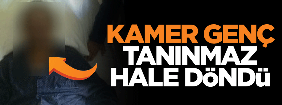 Kamer Genç bu hale döndü