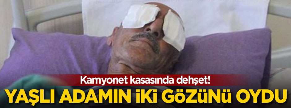 Kamyonet kasasında yaşlı adamın iki gözünü oydu!