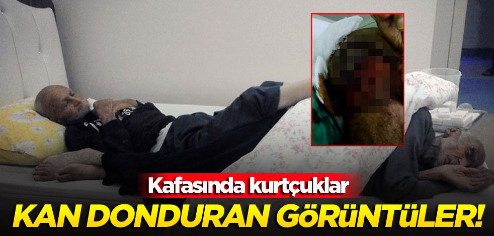 Kan donduran görüntüler! Kafasında kurtçuklar