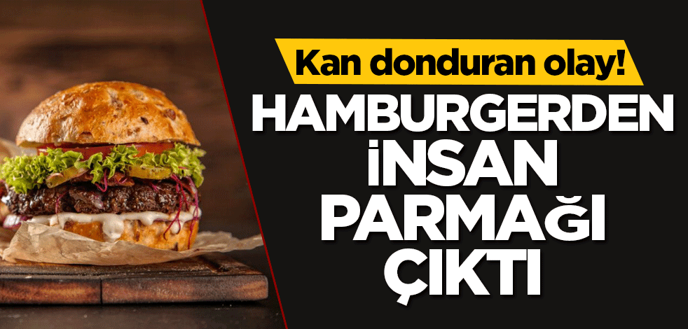 Kan donduran olay! Hamburgerden insan parmağı çıktı