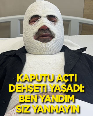 Kaputu açtı, sonrası dehşet: Ben yandım, siz yanmayın!