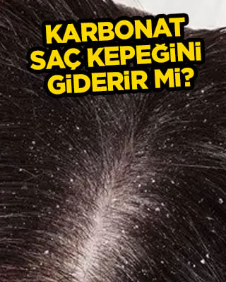  Karbonat saç kepeğini giderir mi? Yeteneği fark edildi: Kepeği böyle kes: Sağlık için bu gizli özelliklerini keşfedin
