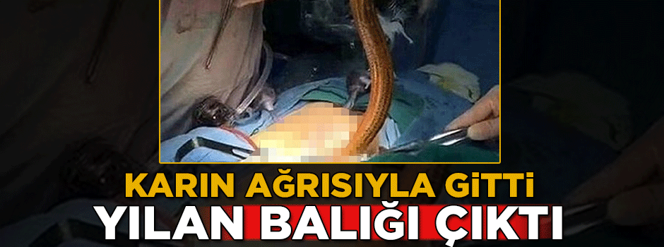 Karın ağrısı şikayetiyle gitti, yılan balığı çıktı