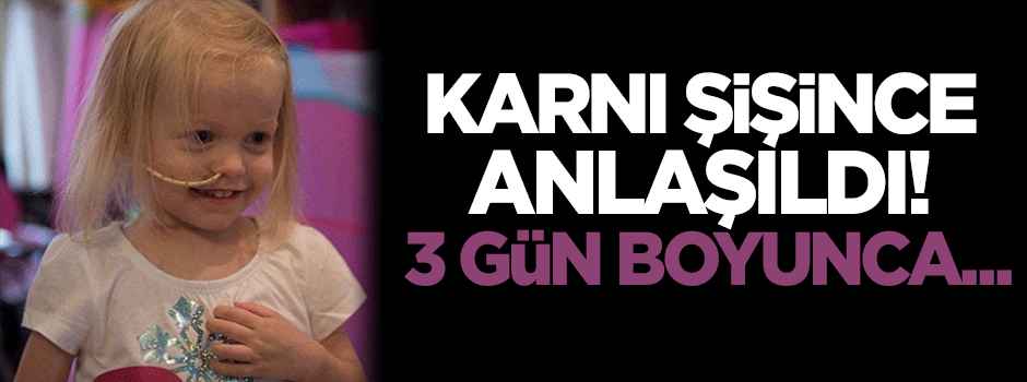 Karnı şişince anlaşıldı!