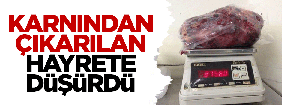 Karnından çıkarılan hayrete düşürdü