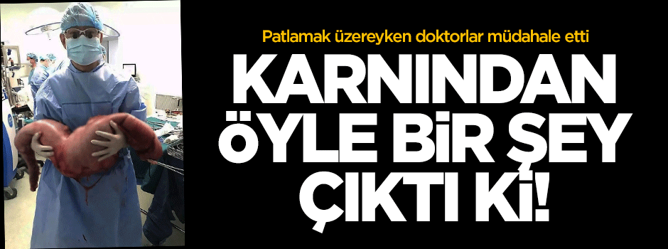 Karnından öyle bir şey çıktı ki!