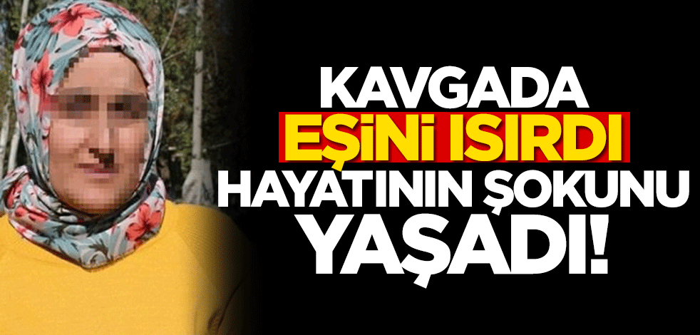 Kavgada eşini ısırdı, para cezası yedi!