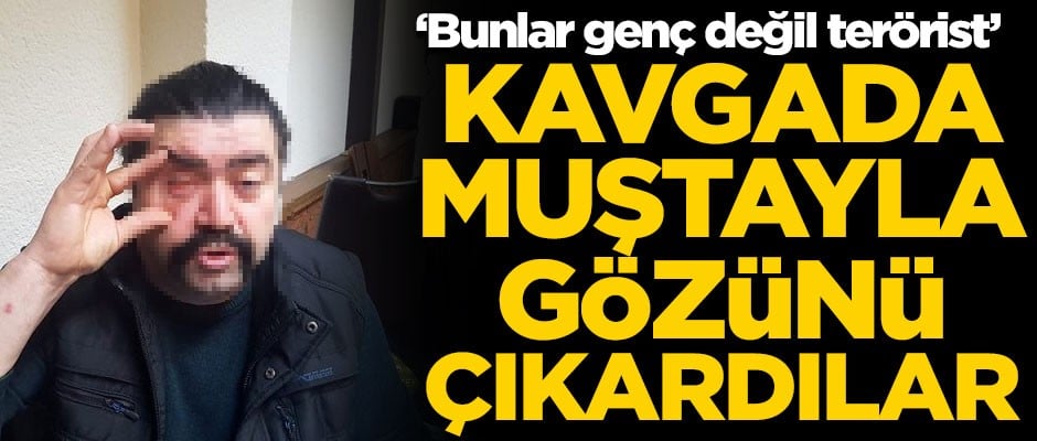 Kavgada gözünü çıkardılar! "Bunlar genç değil terörist"