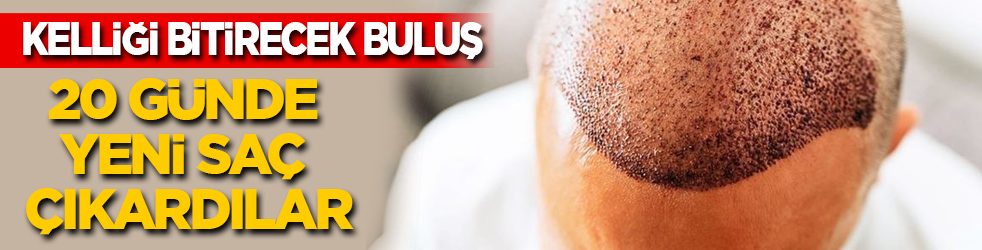 Kelliği bitirecek buluş: 20 günde saç çıkardılar