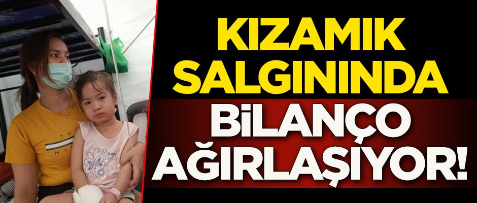 Kızamık salgınında bilanço ağırlaşıyor: 261 kişi hayatını kaybetti