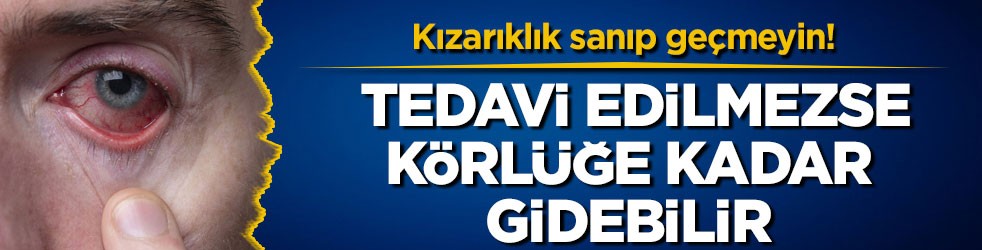 Kızarıklık sanıp geçmeyin! Tedavi edilmezse körlüğe kadar gidebilir