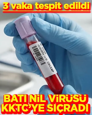 KKTC'de Biri rutin kontrolde 3 Batı Nil virüsü tespit edildi