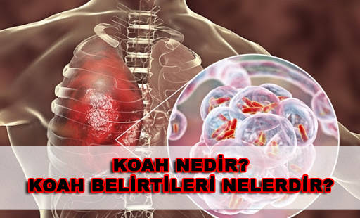 Koah hastalığı nedir? Koah hastalığı kimlerde görülür belirtileri neler?