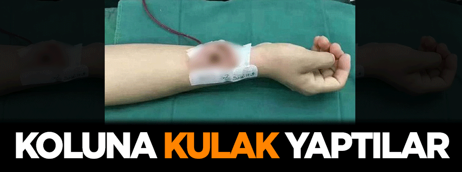 Koluna 'kulak' yaptılar