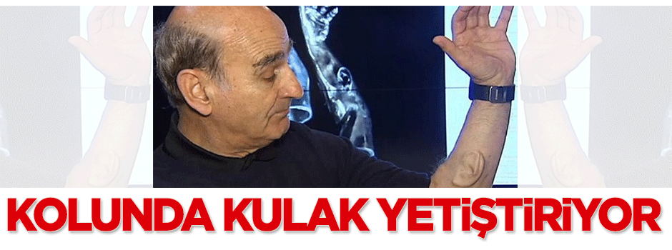 Kolunda kulak yetiştiriyor