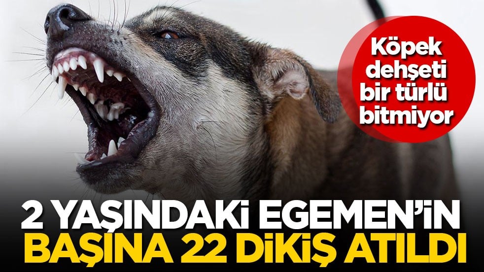 Köpek dehşeti bir türlü bitmiyor! 2 yaşındaki Egemen’in başına 22 dikiş atıldı