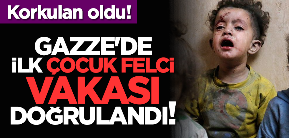 Korkulan oldu: Gazze'de ilk çocuk felci vakası doğrulandı!