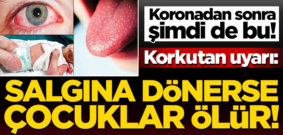 Koronadan sonra şimdi de bu! 'Kawasaki' salgına dönerse çocuklar ölür
