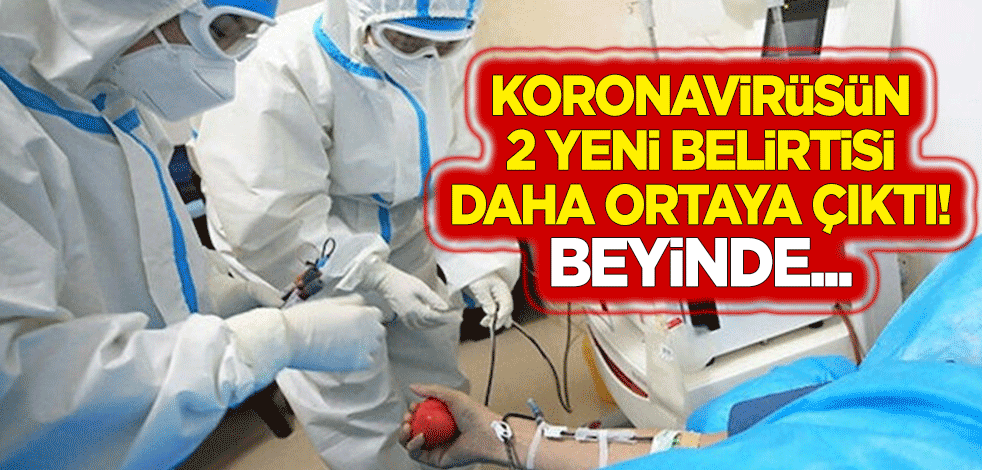 Koronavirüsün 2 yeni belirtisi daha ortaya çıktı! Beyinde...
