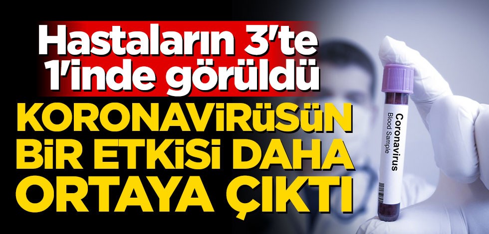 Koronavirüsün bir etkisi daha ortaya çıktı