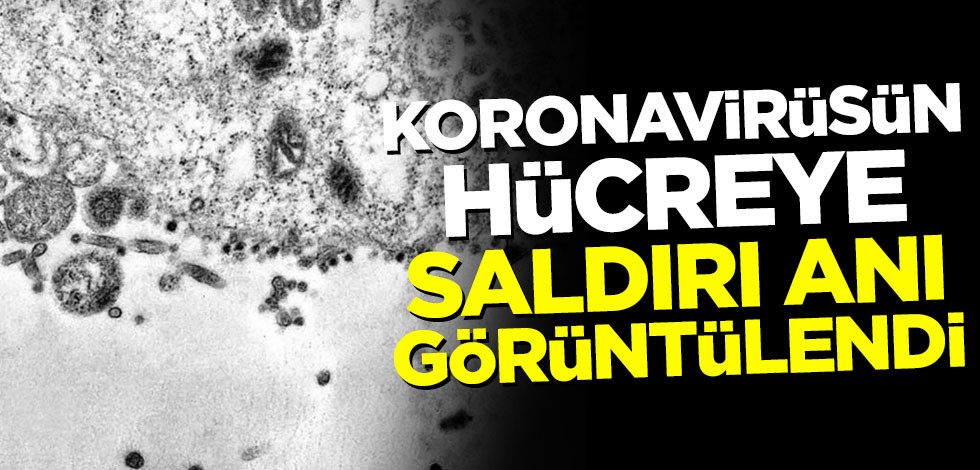 Koronavirüsün hücreye saldırı anı görüntülendi!