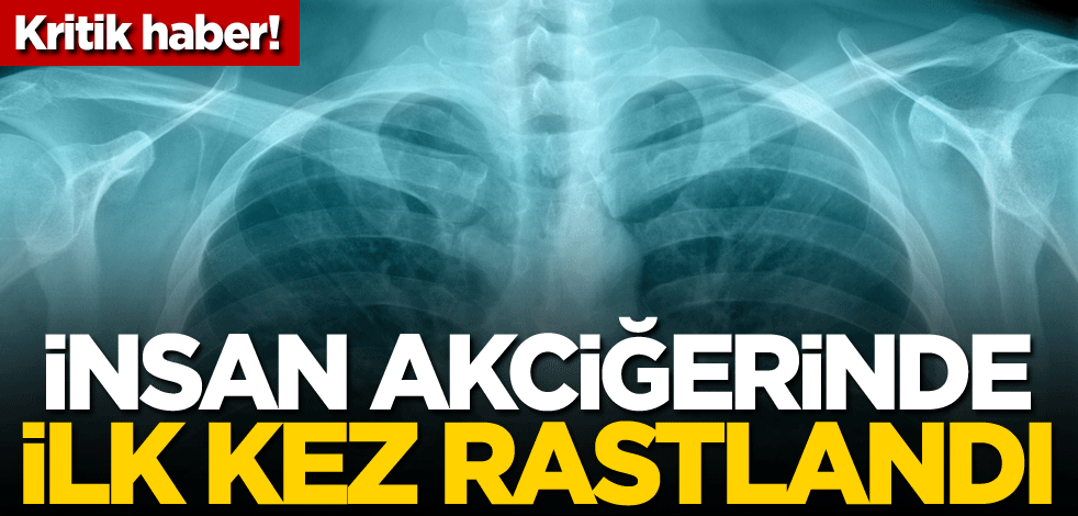 Kritik haber! İnsan akciğerinde ilk kez rastlandı