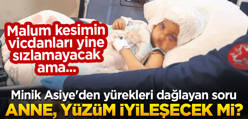Malum kesimin vicdanları yine sızlamayacak ama... Minik Asiye'den yürekleri dağlayan soru: Anne, yüzüm iyileşecek mi?