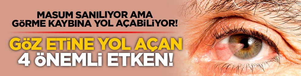 Masum sanılıyor ama görme kaybına yol açabiliyor! Göz etine yol açan 4 önemli etken!