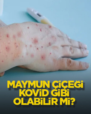 Maymun çiçeği, kovid gibi olabilir mi?