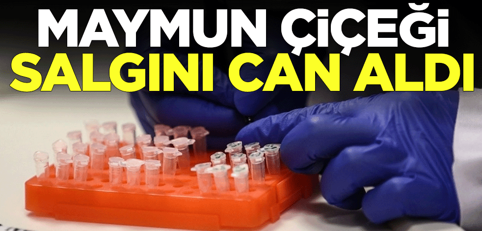 Maymun çiçeği salgını! 24 kişinin öldüğünü açıkladılar