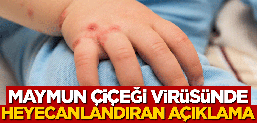 Maymun çiçeği virüsünde heyecanlandıran açıklama