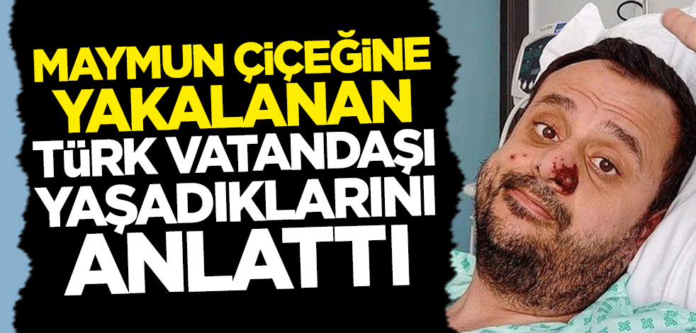 Maymun çiçeğine yakalanan Türk vatandaşı yaşadıklarını anlattı