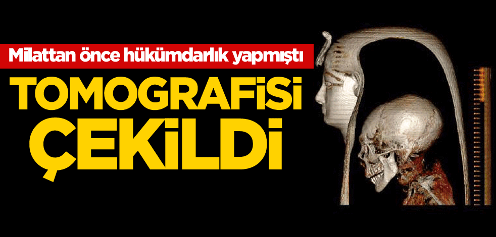 Milattan önce hükümdarlık yapmıştı! Tomografisi çekildi