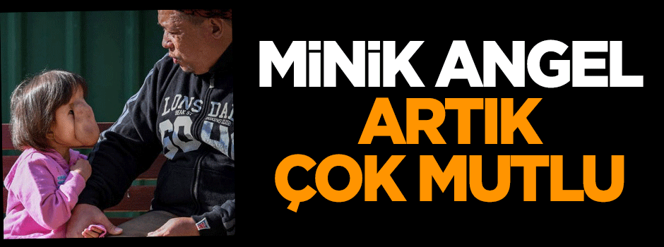 Minik Angel artık gülümseyebiliyor!