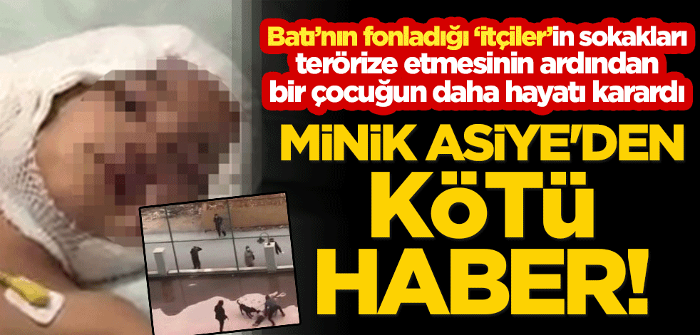 Minik Asiye'den kötü haber! 'İtçiler'in sokakları terörize etmesinin ardından bir çocuğun daha hayatı karardı!