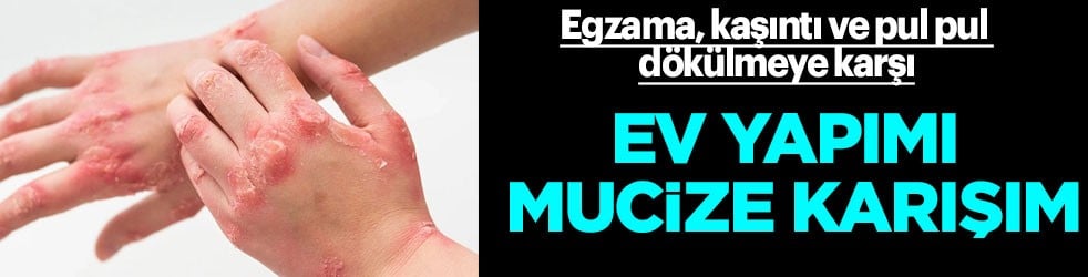 Mucize karışım: Ciltteki kaşıntıyı ve egzamayı bıçak gibi kesiyor! Pul pul dökülmeye karşı koruma yapıyor! Hangi karışım?