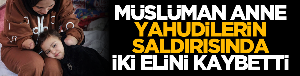 Müslüman anne Yahudilerin saldırısında iki elini kaybetti