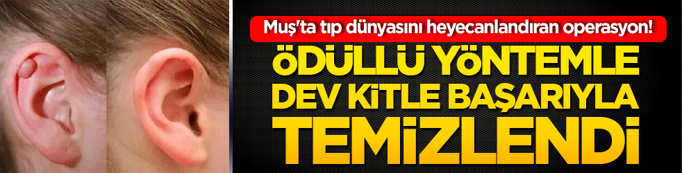 Muş'ta tıp dünyasını heyecanlandıran operasyon! Ödüllü yöntemle dev kitle başarıyla temizlendi