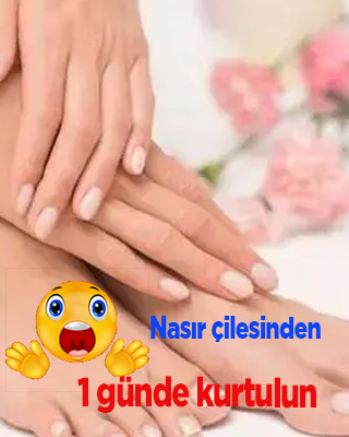 Nasır çilesinden 1 günde kurtulun, nasıl mı? İşte cevabı..