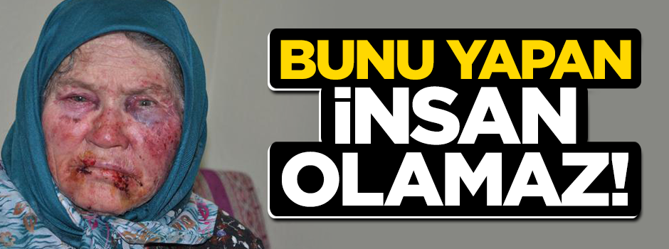 'Oğlunun arkadaşıyım' dedi, yaşlı kadını öldüresiye dövdü!