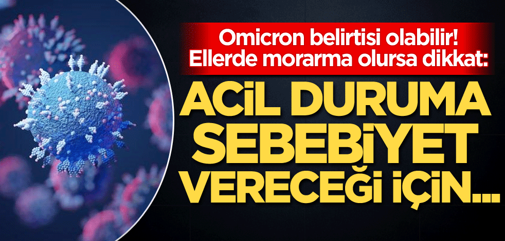 Omicron belirtisi olabilir! Ellerde morarma olursa dikkat: Acil duruma sebebiyet vereceği için...