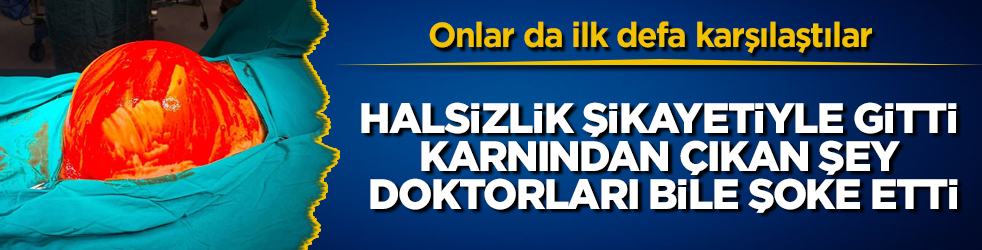 Onlar da ilk defa karşılaştılar! Halsizlik şikayetiyle gitti, karnından &ccedil;ıkan şey doktorları bile şoke etti
