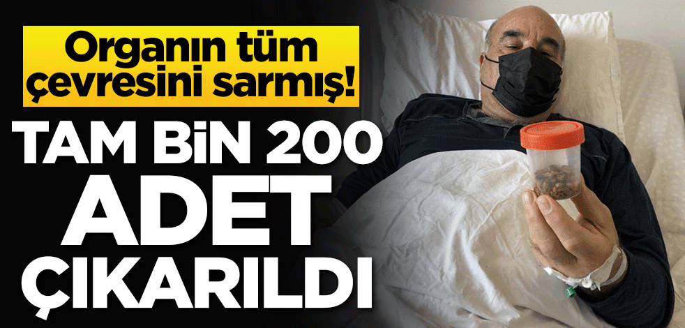 Organın tüm çevresini sarmış! Tam bin 200 adet çıkarıldı