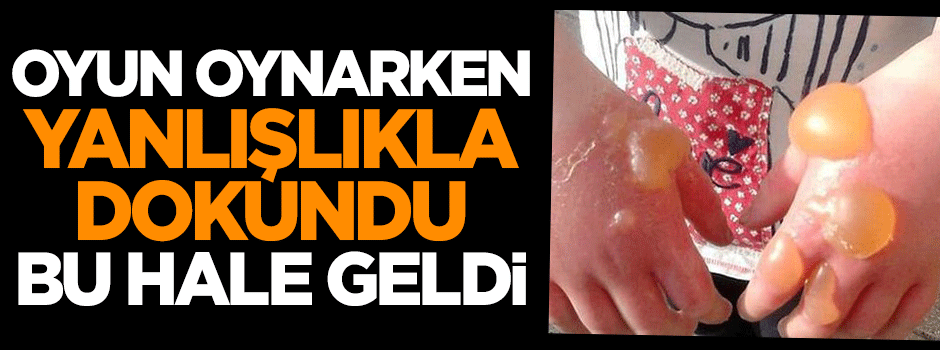 Oyun oynarken yanlışlıkla dokundu, bu hale geldi!