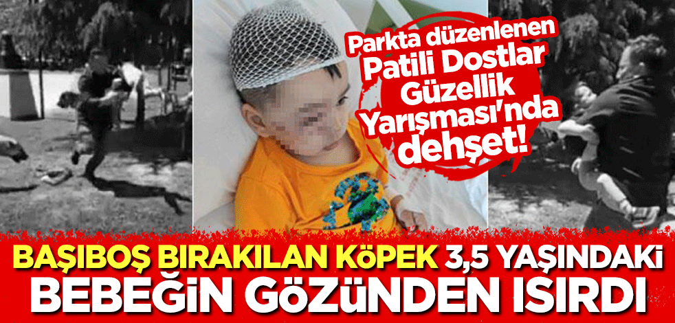 Parkta düzenlenen Patili Dostlar Güzellik Yarışması'nda dehşet! Başıboş bırakılan köpek 3,5 yaşındaki bebeği gözünden ısırdı