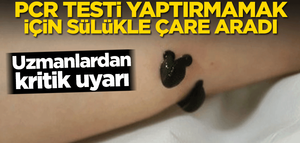 PCR testi yaptırmamak için sülükle çare aradı! Uzmanlardan uyarı